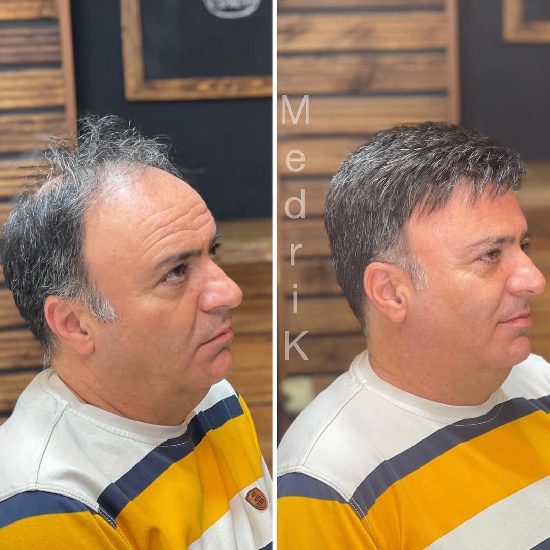 Look Your Best with the Perfect Wig