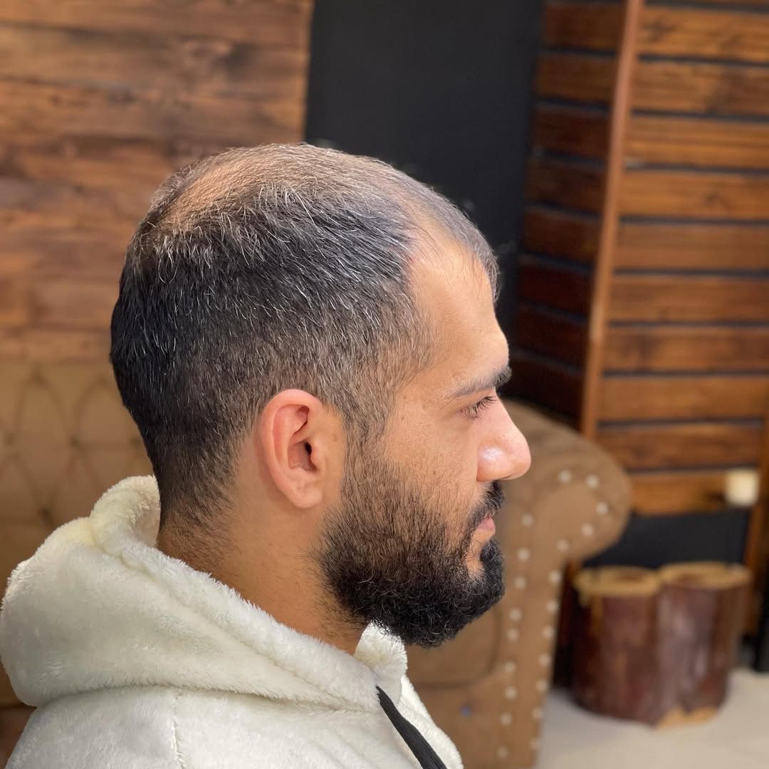 Befor using our services