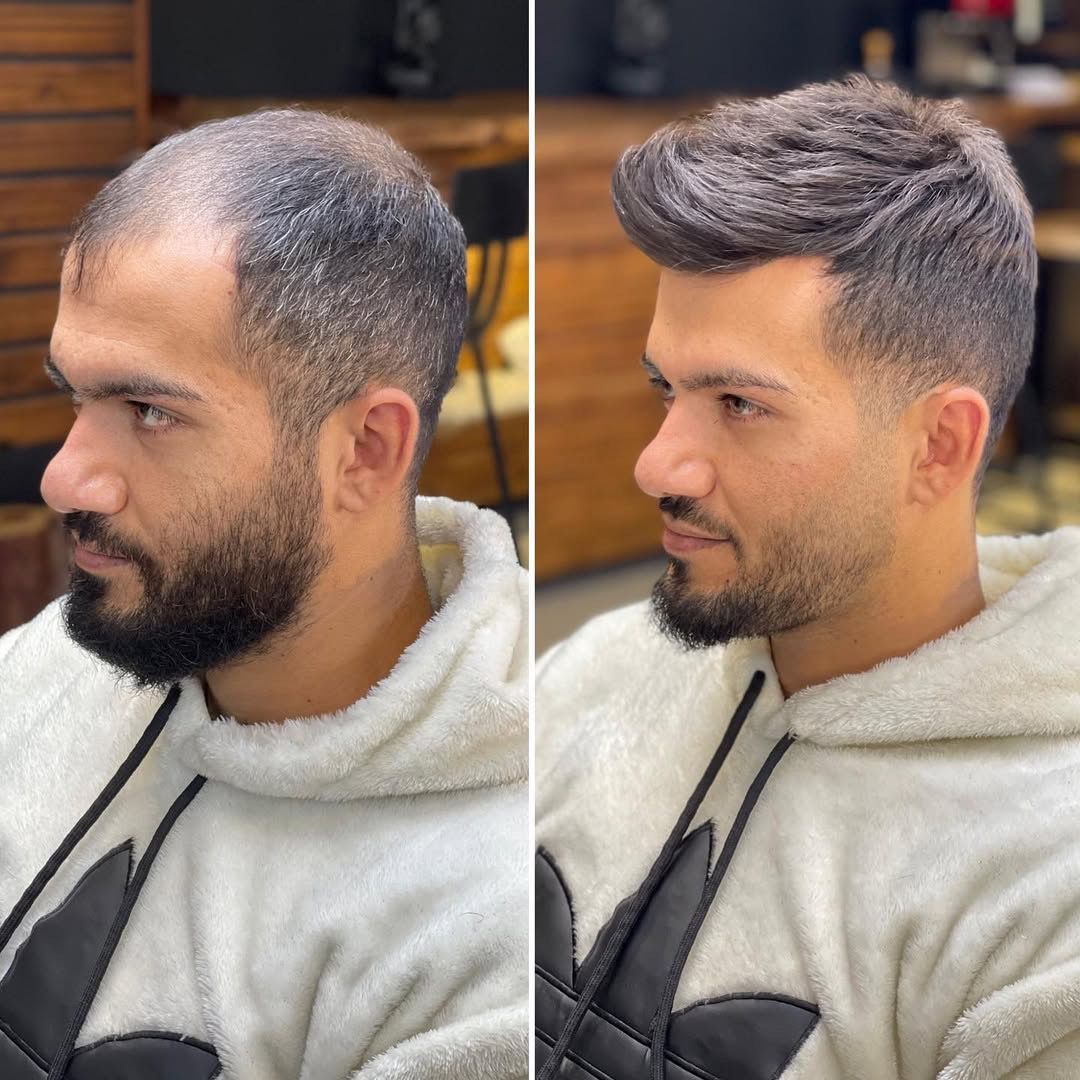 Upgrade Your Style with a Stunning Wig Look