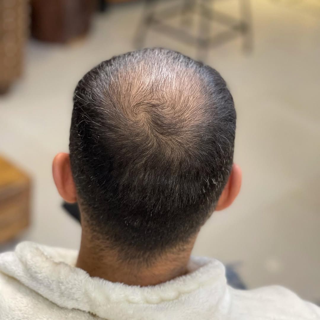 Life Before Our Products